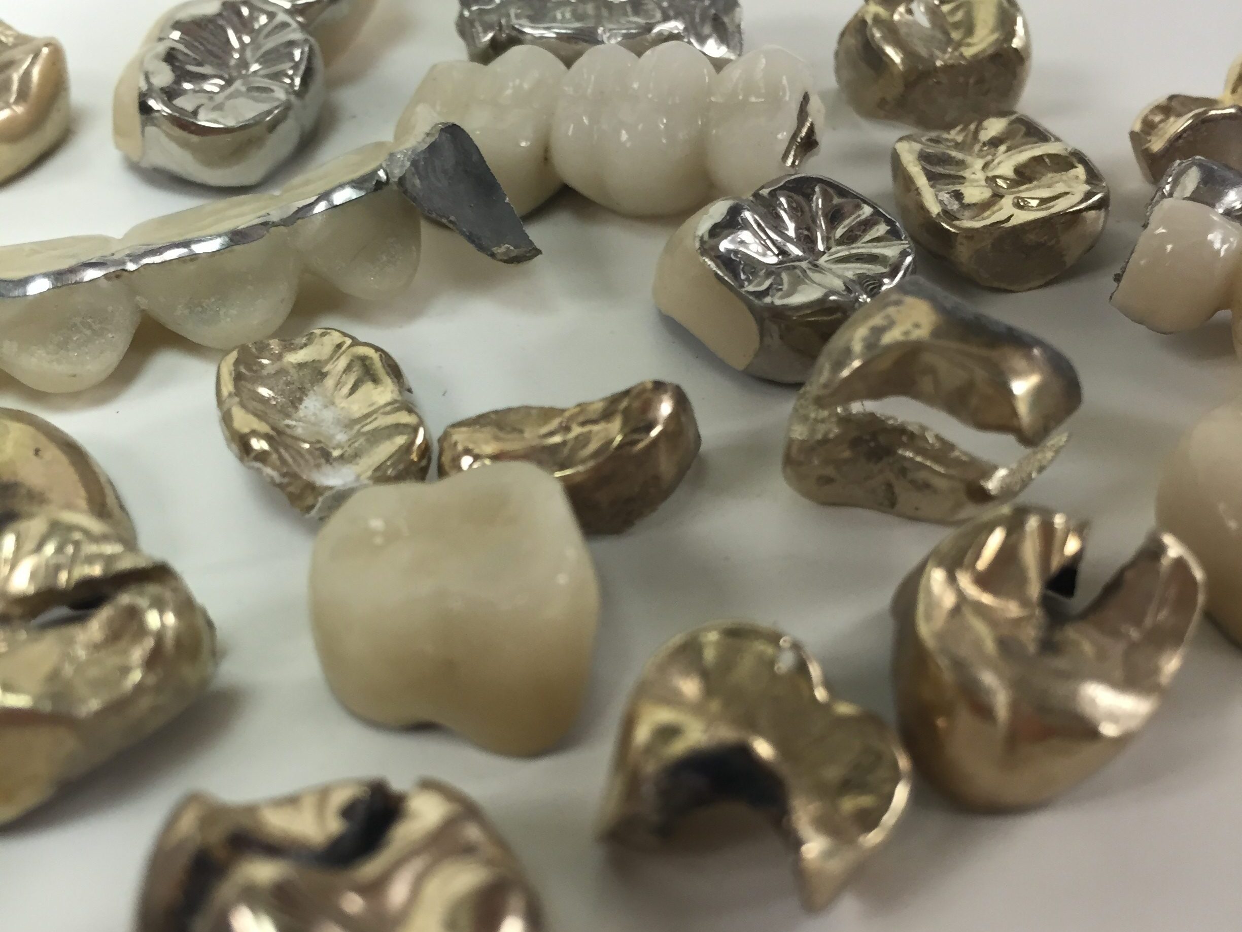 When looking for the best place to sell dental gold, do your due diligence on the company.